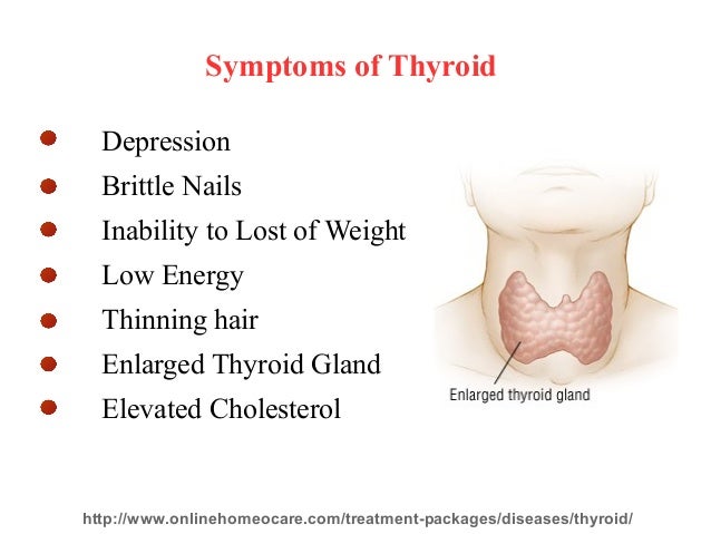 thyroid treatment in homeopathy thyroid treatment in homeopathy